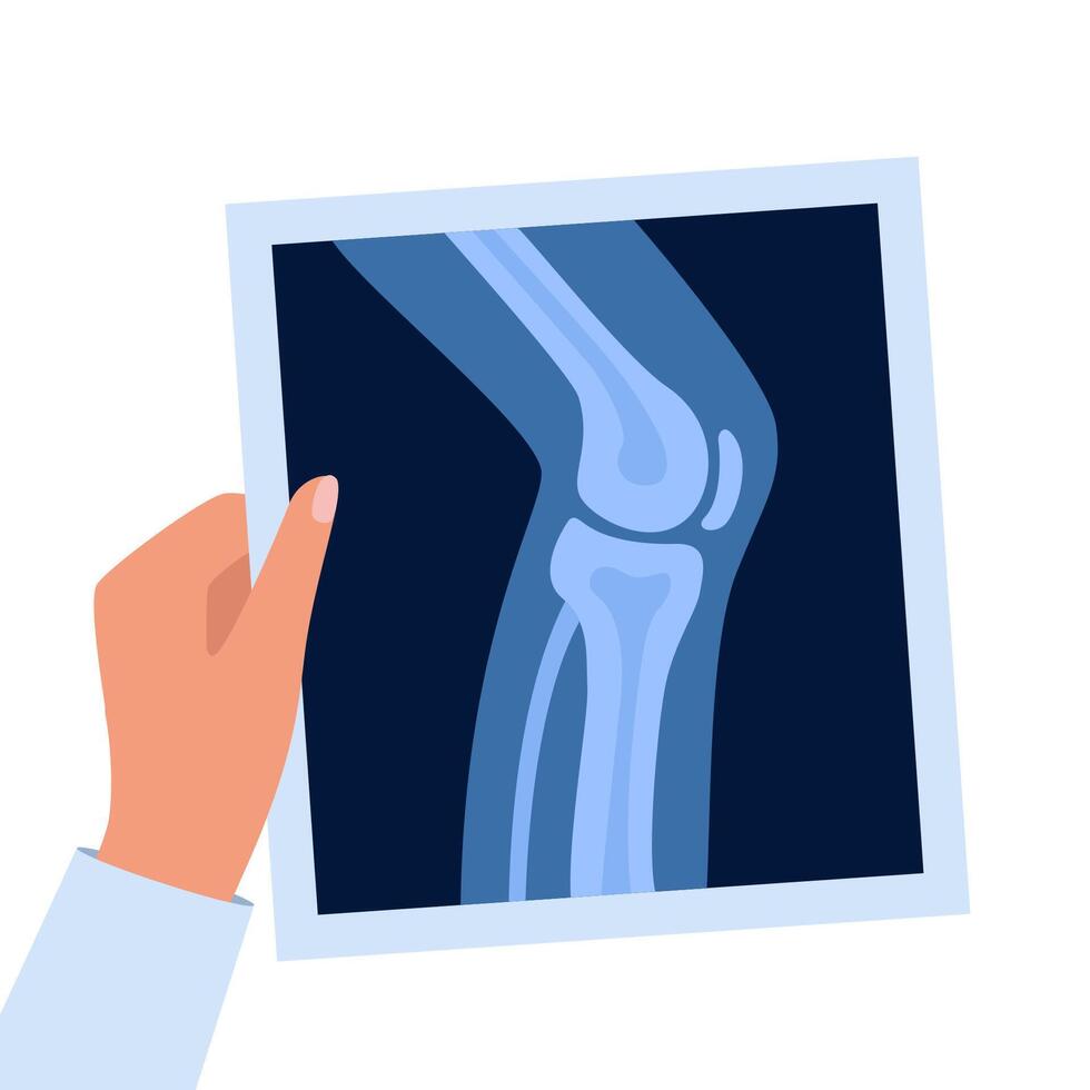 X-ray anatomy of the knee joint and human leg. Roentgen shot in doctors hand. vector