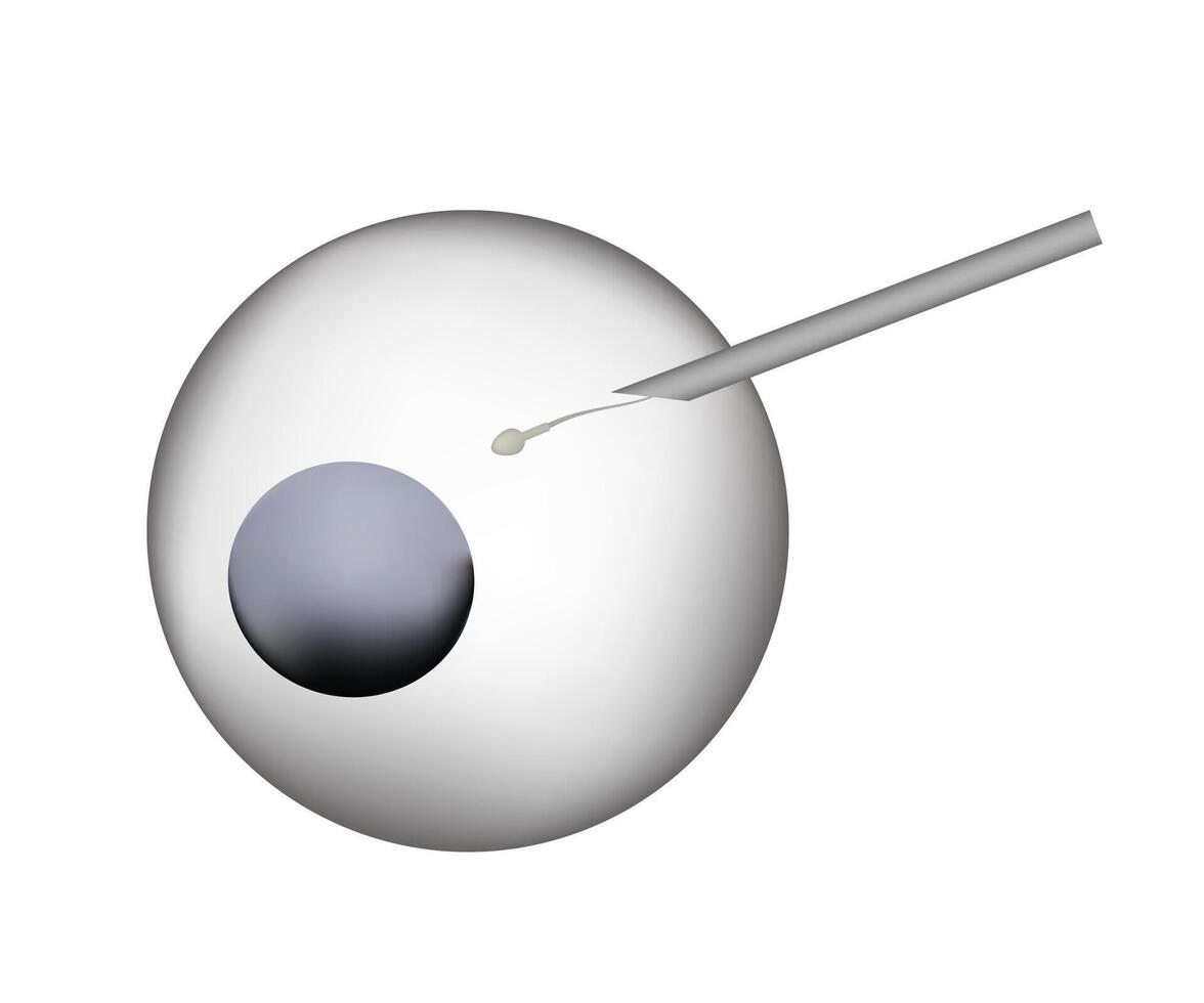 Artificial insemination injecting sperm into female egg cell vector
