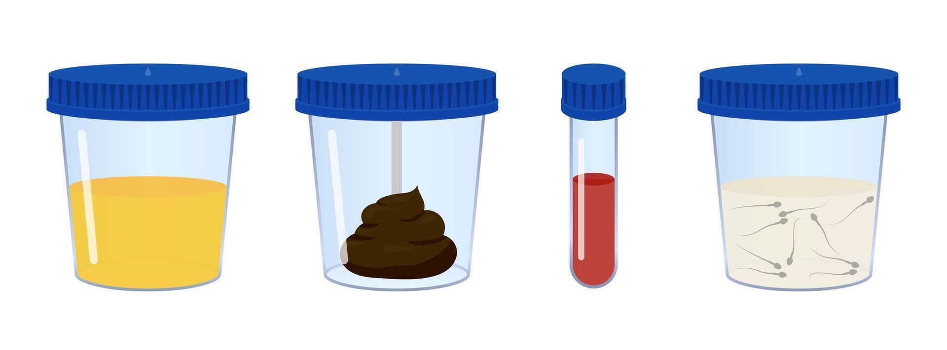 Medical analysis containing urine, feces, blood and sperm samples vector
