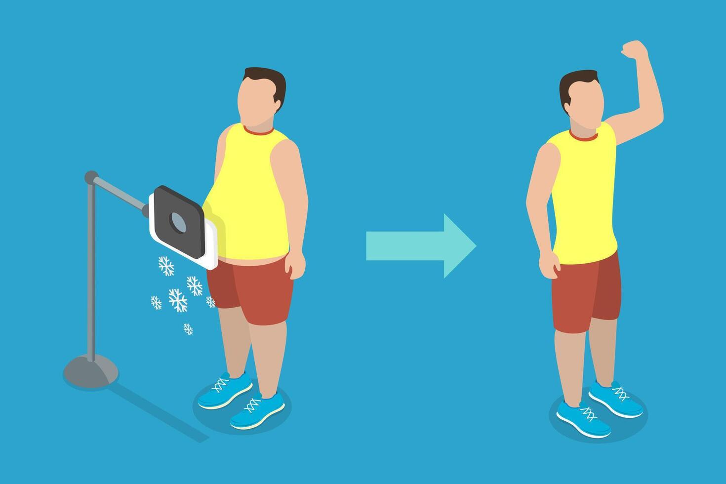 3D Isometric Flat Illustration of Cryolipolysis, Non-invasive Body Fat Cooling vector