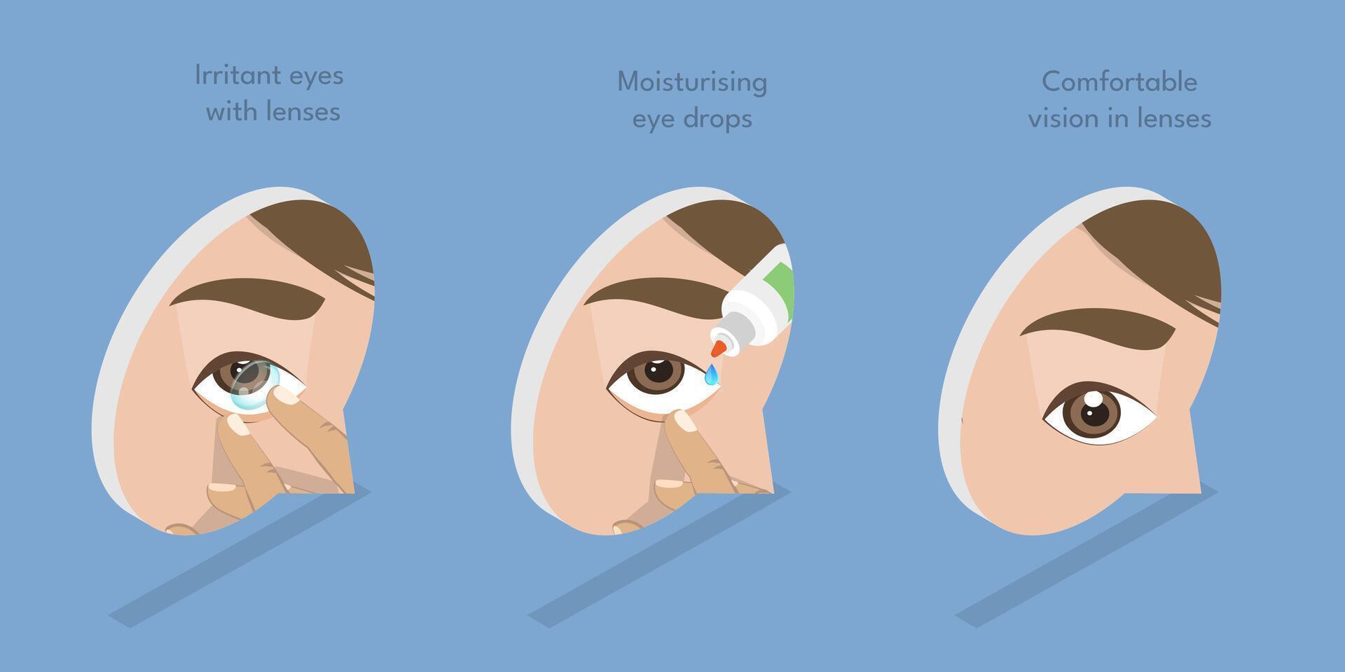 3D Isometric Flat Illustration of Moisturizing Eye Drops, Using of Artificial Tears vector