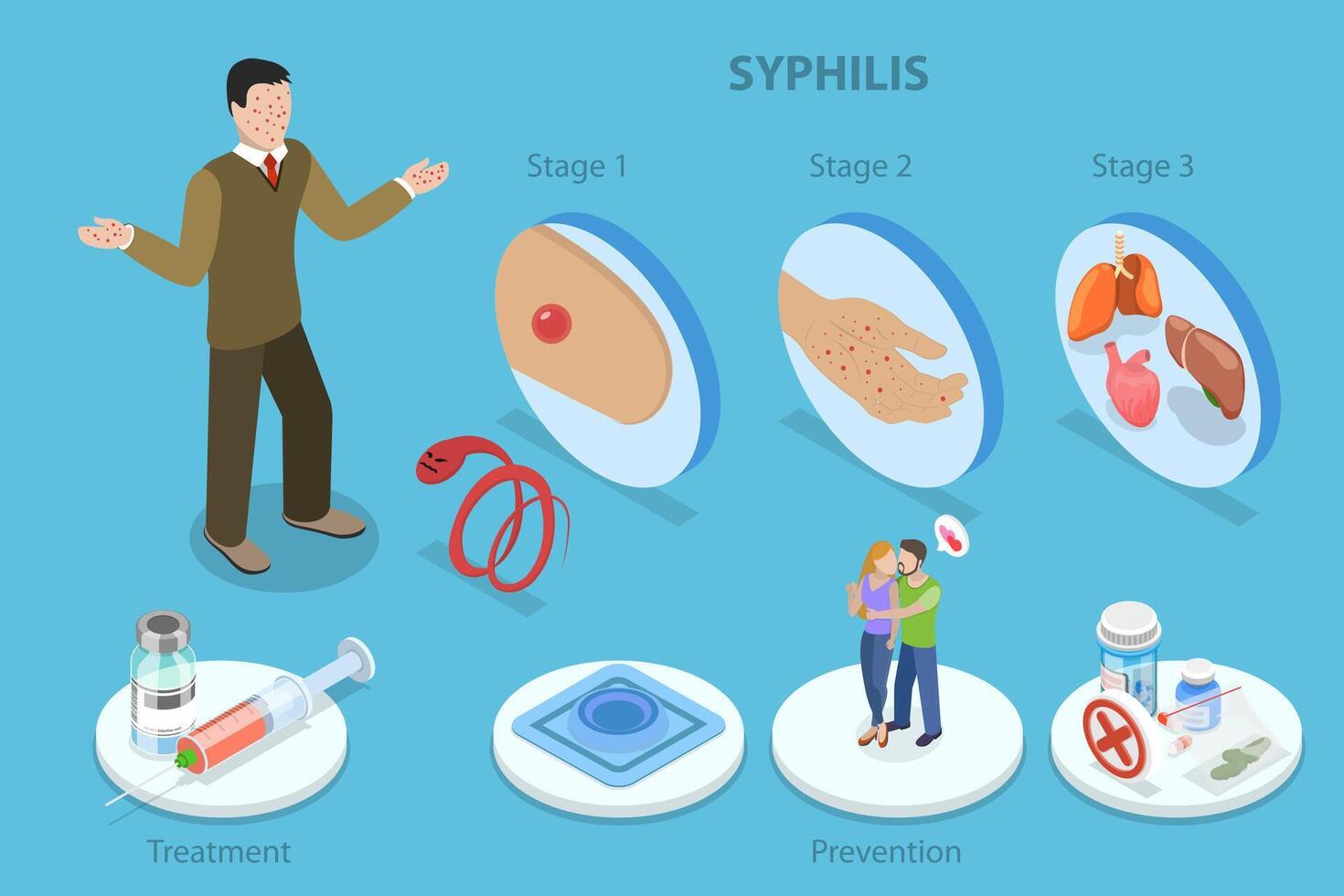 3D Isometric Flat Illustration of Syphilis, Sexually Transmitted Infection vector
