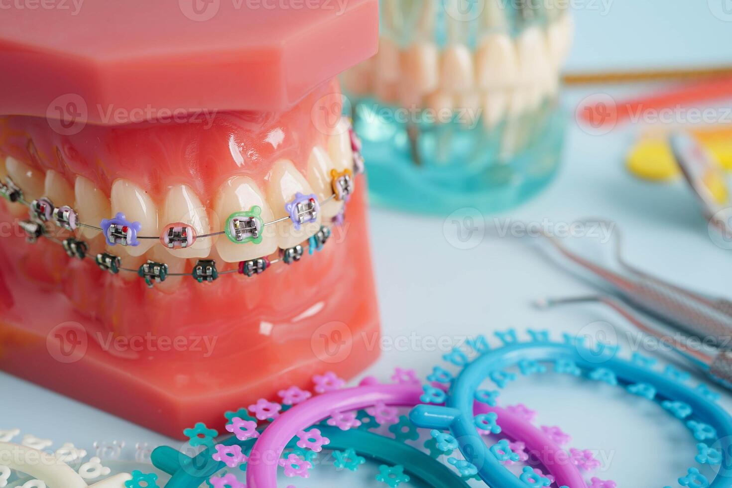 Orthodontic ligatures rings and ties, elastic rubber bands on orthodontic braces, model for dentist studying about photo
