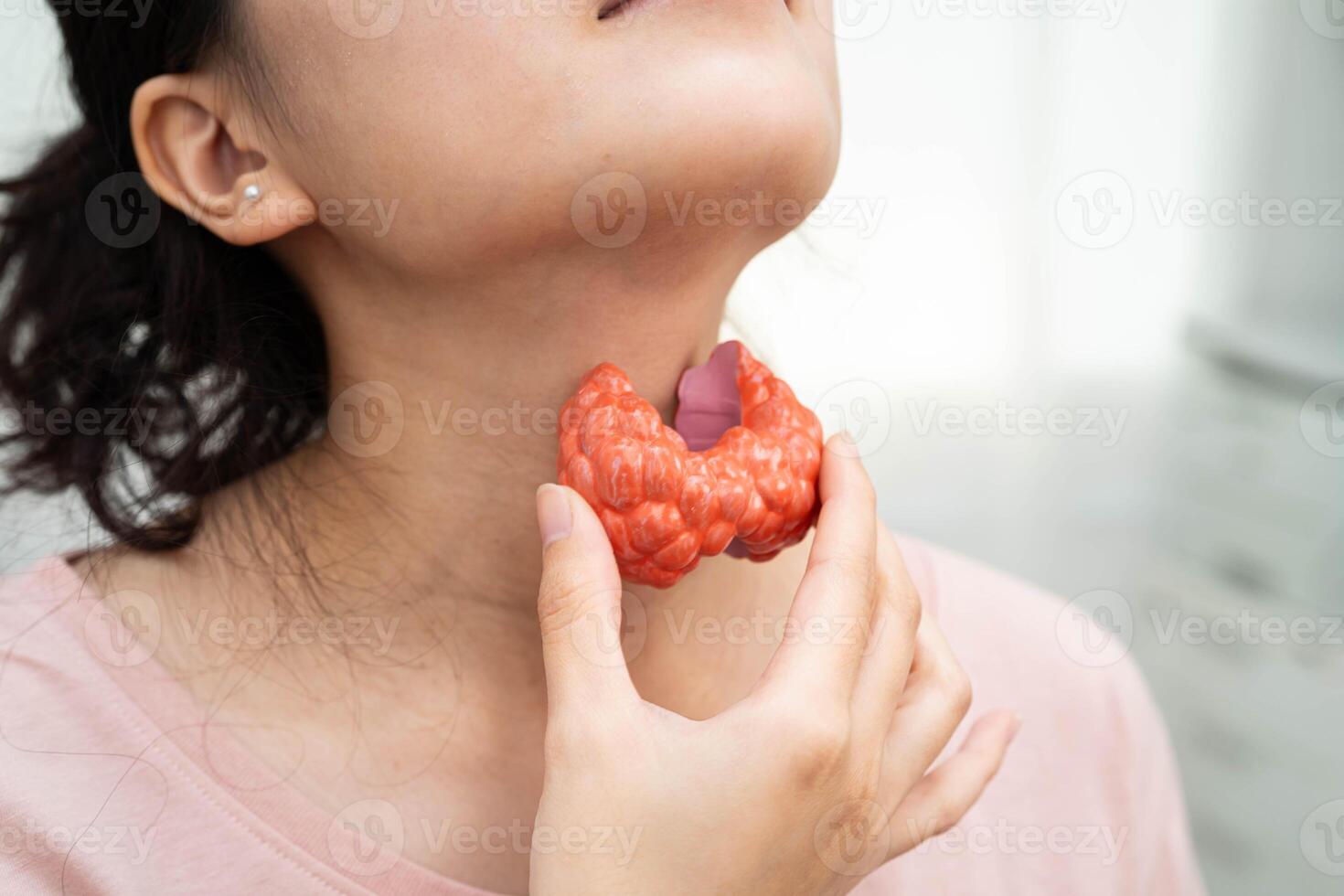 Hyperthyroidism, Overactive Thyroid, Thyroid Lymphoma, Asian woman with thyroid photo