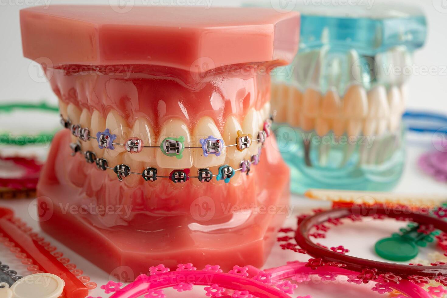 Orthodontic ligatures rings and ties, elastic rubber bands on orthodontic braces, model for dentist studying photo