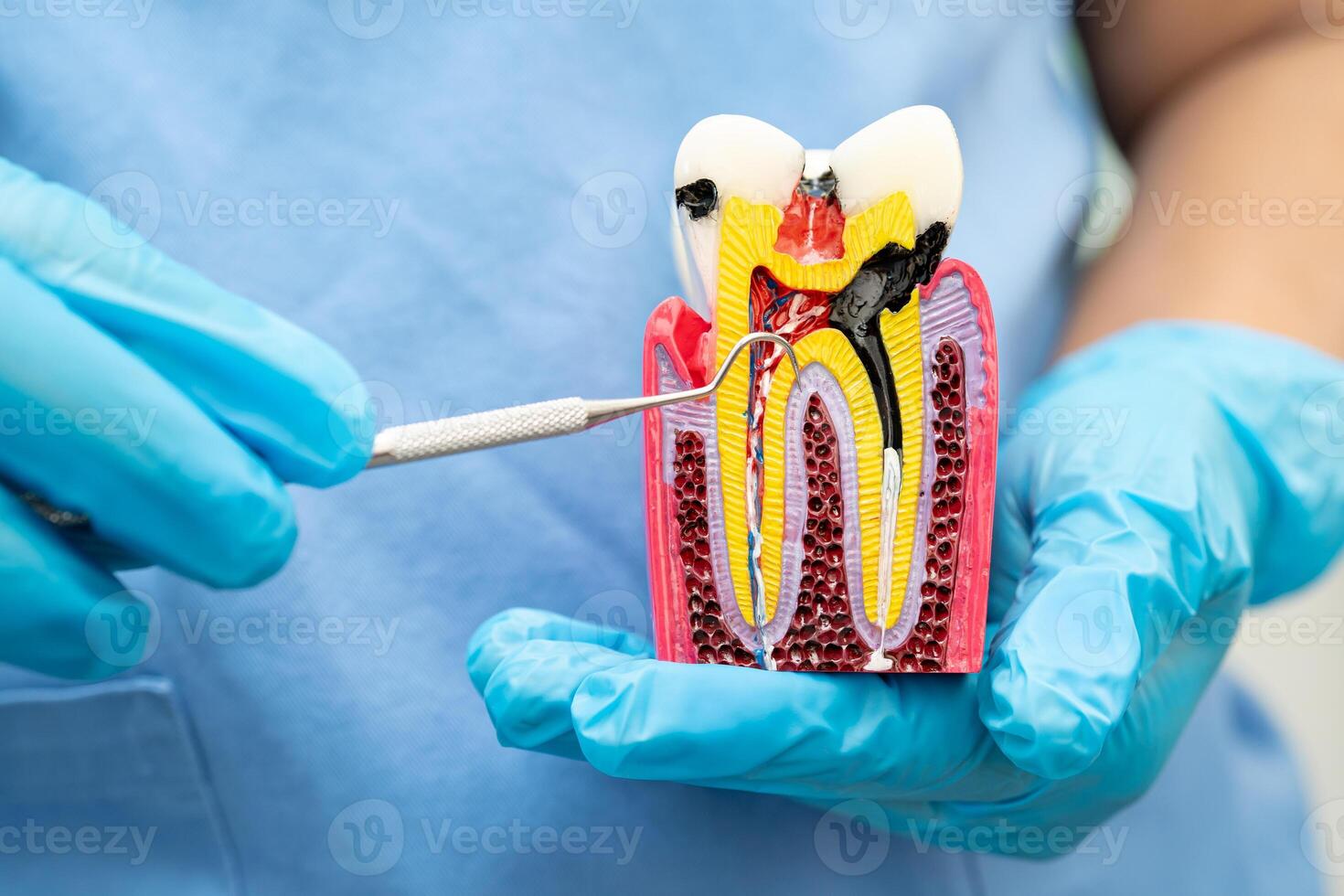 Teeth root dental model photo