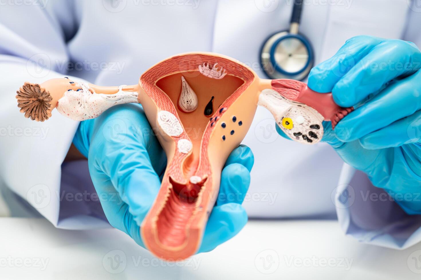 Uterus, doctor holding human anatomy model for study diagnosis and treatment photo