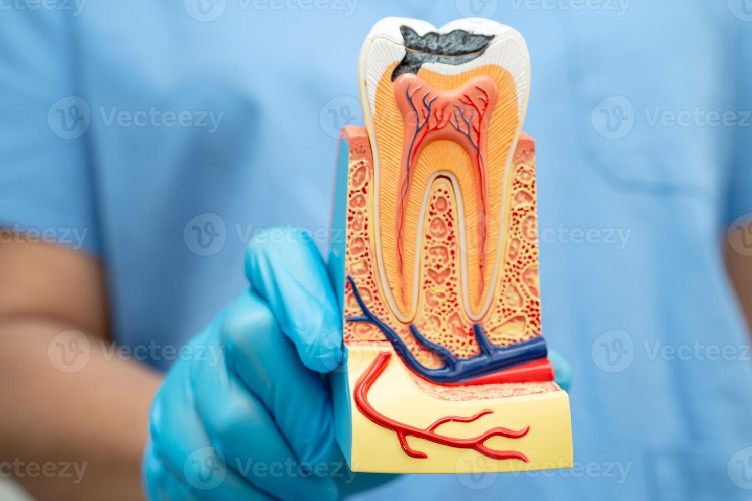 Dental implant, artificial tooth roots into jaw photo