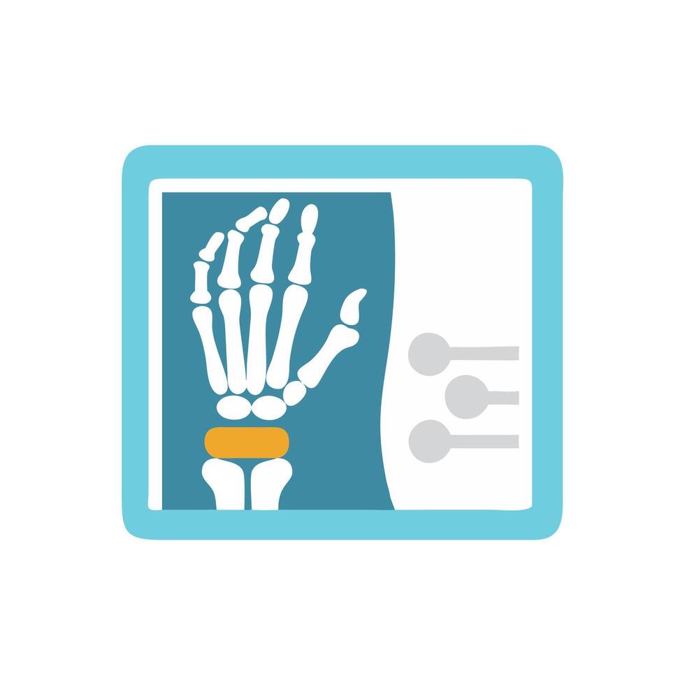 Colorful flat xray illustration of a hand vector