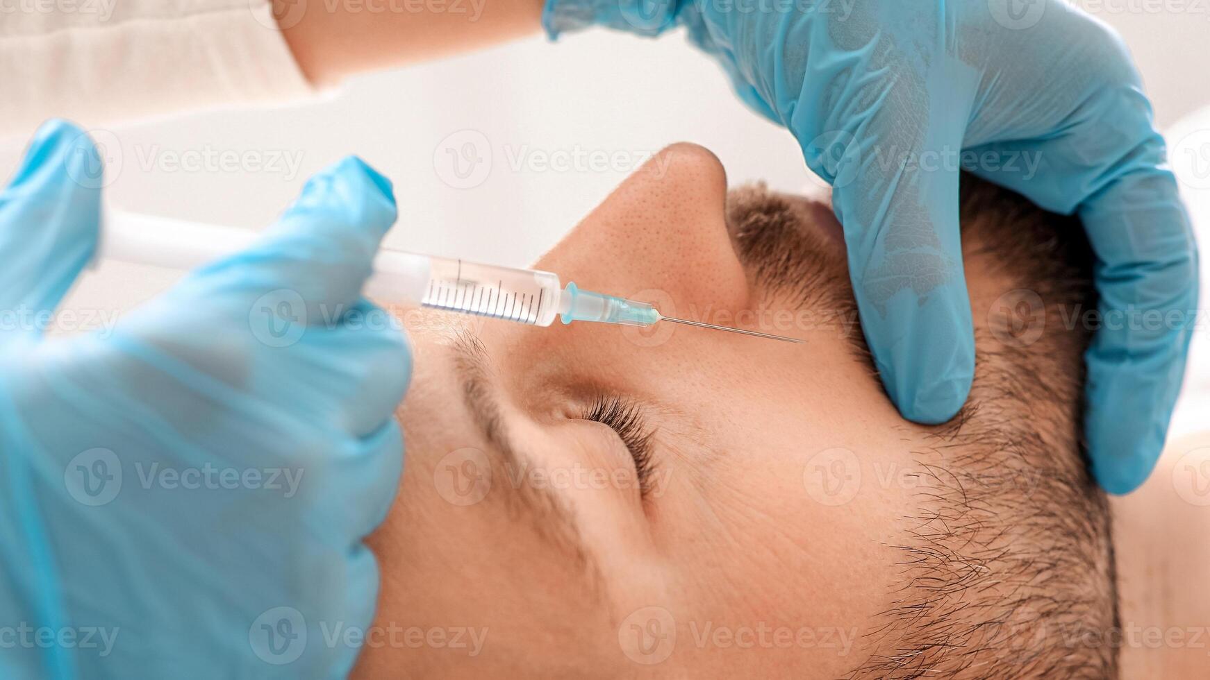 Closeup of middle-aged man getting nasolabial injection at aesthetic clinic. Plastic surgeon injecting anti-aging filler in handsome bearded man face. Male cosmetology, aesthetic medicine concept photo