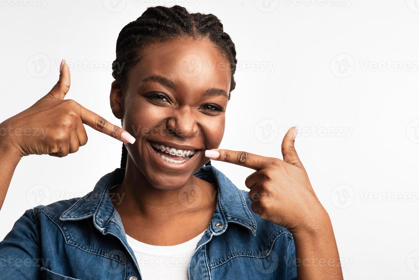 Joyful Black Girl In Orthodontic Braces Smiling Pointing Fingers At Brackets On Her Teeth Posing Over White Background. Studio Shot photo