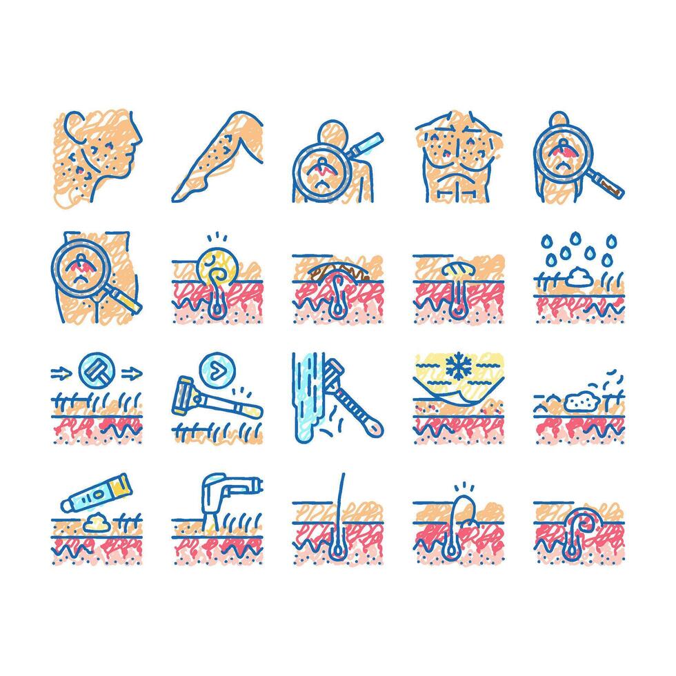 Ingrown Hair Problem Treatment Icons hand drawn vector