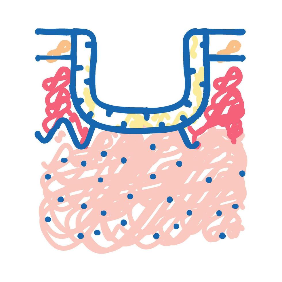 hypertrophic acne scar icon doodle illustration vector