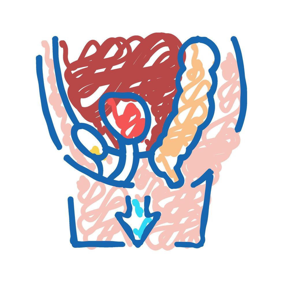 organ prolapse disease icon doodle illustration vector