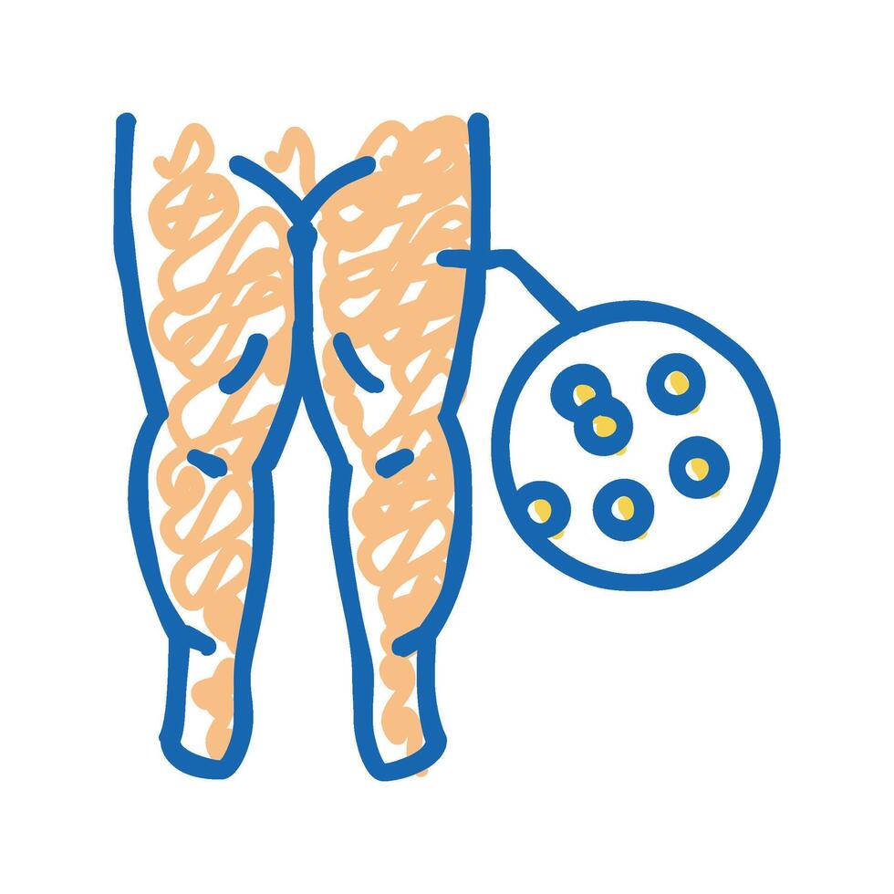 hypoproteinemic edema icon doodle illustration vector