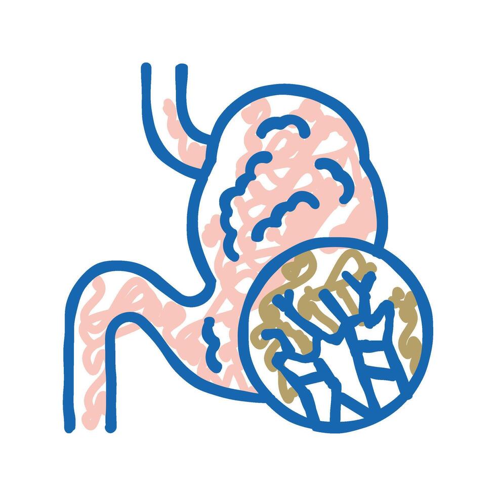 abdominal swelling mesothelioma icon doodle illustration vector