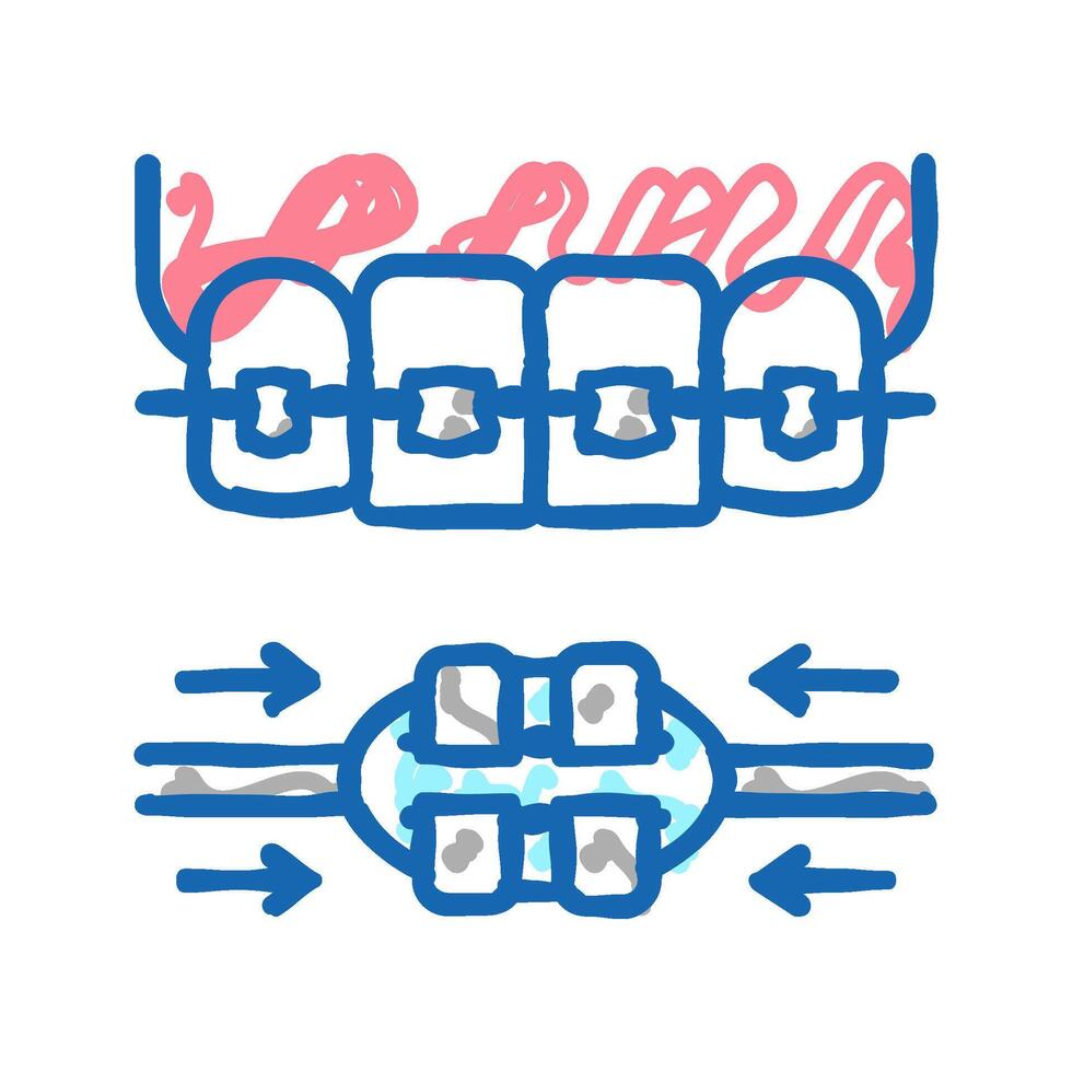 work process tooth braces icon doodle illustration vector