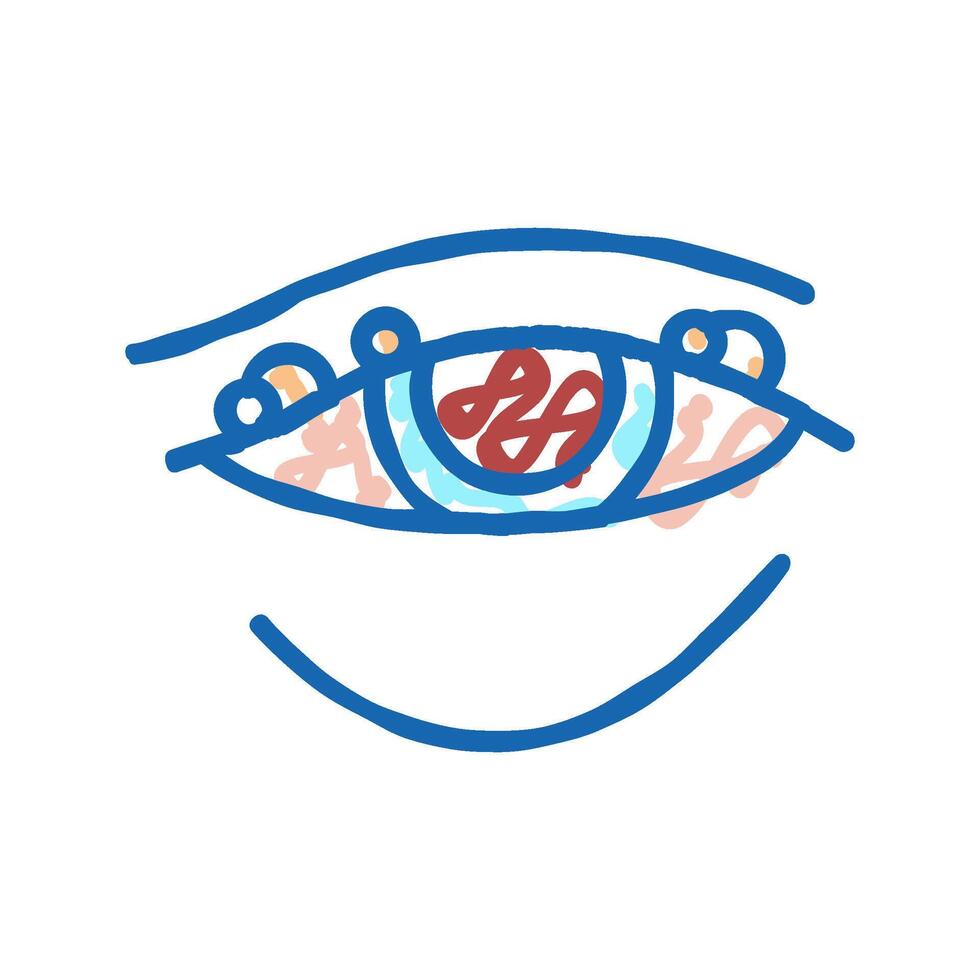 blepharitis disease, redness of eyeball icon doodle illustration vector
