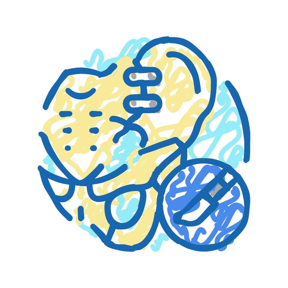 joint fusion surgery icon doodle illustration vector
