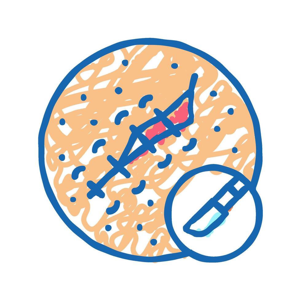 surgical excision mole removal icon doodle illustration vector