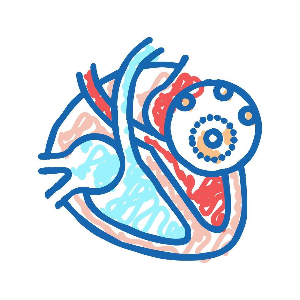 myocarditis disease icon doodle illustration vector