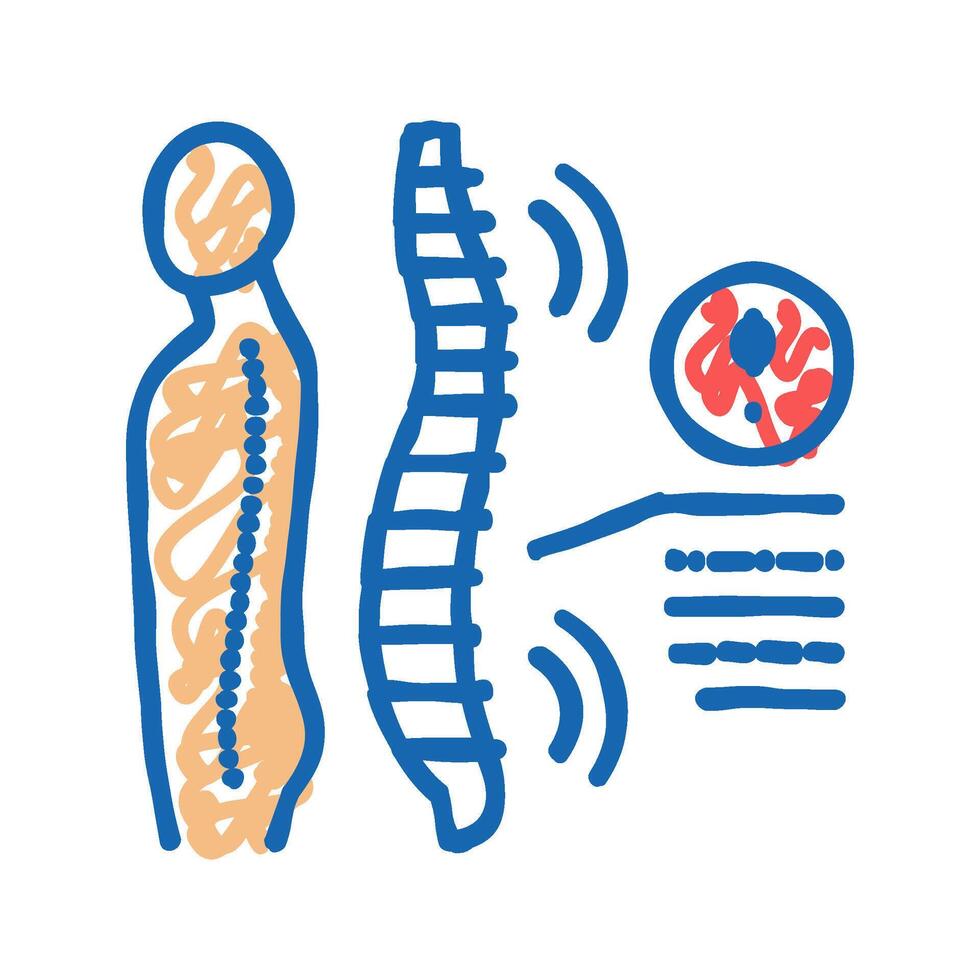 spondyloarthropathies health problem icon doodle illustration vector