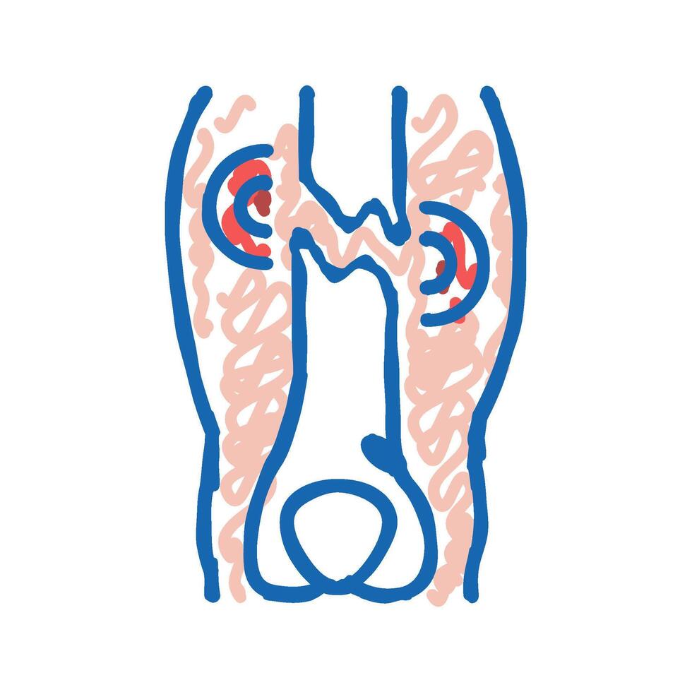 closed limb fracture disease icon doodle illustration vector