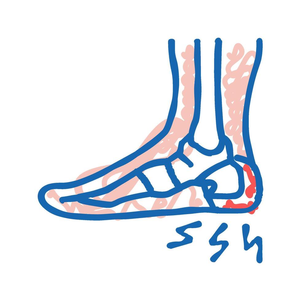 heel spur disease icon doodle illustration vector