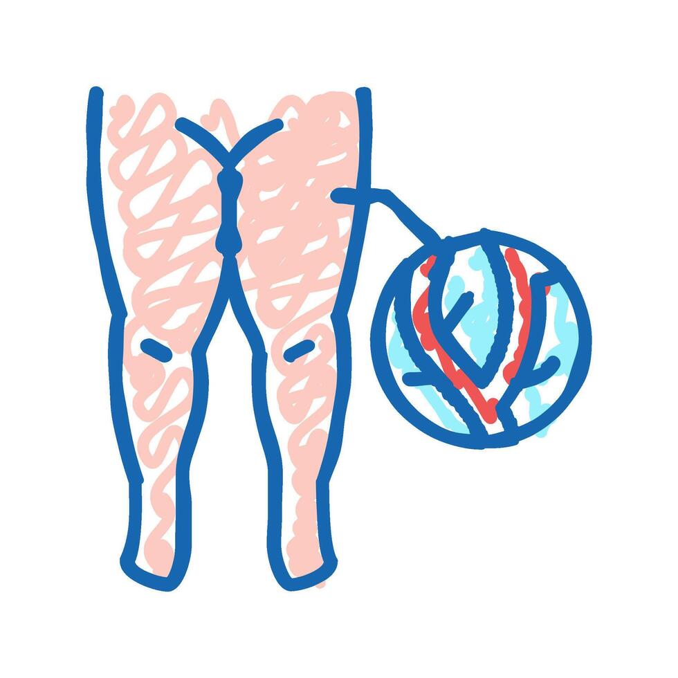 lymphatic edema icon doodle illustration vector