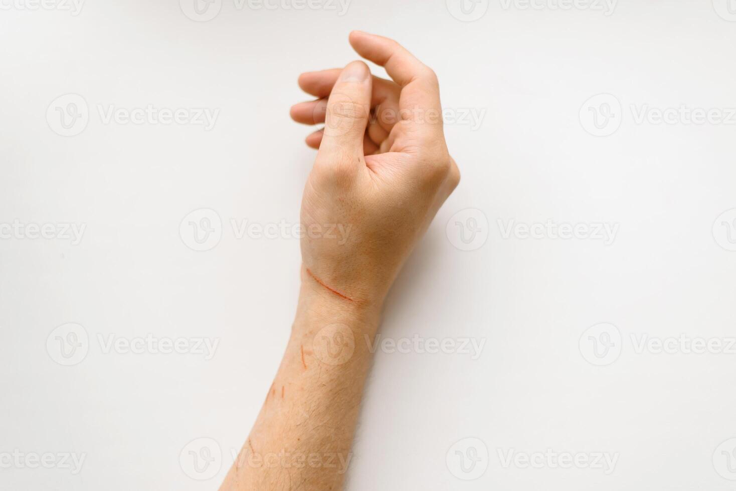 Scratched hand on a white background, top view. Skin scratches from a cat photo