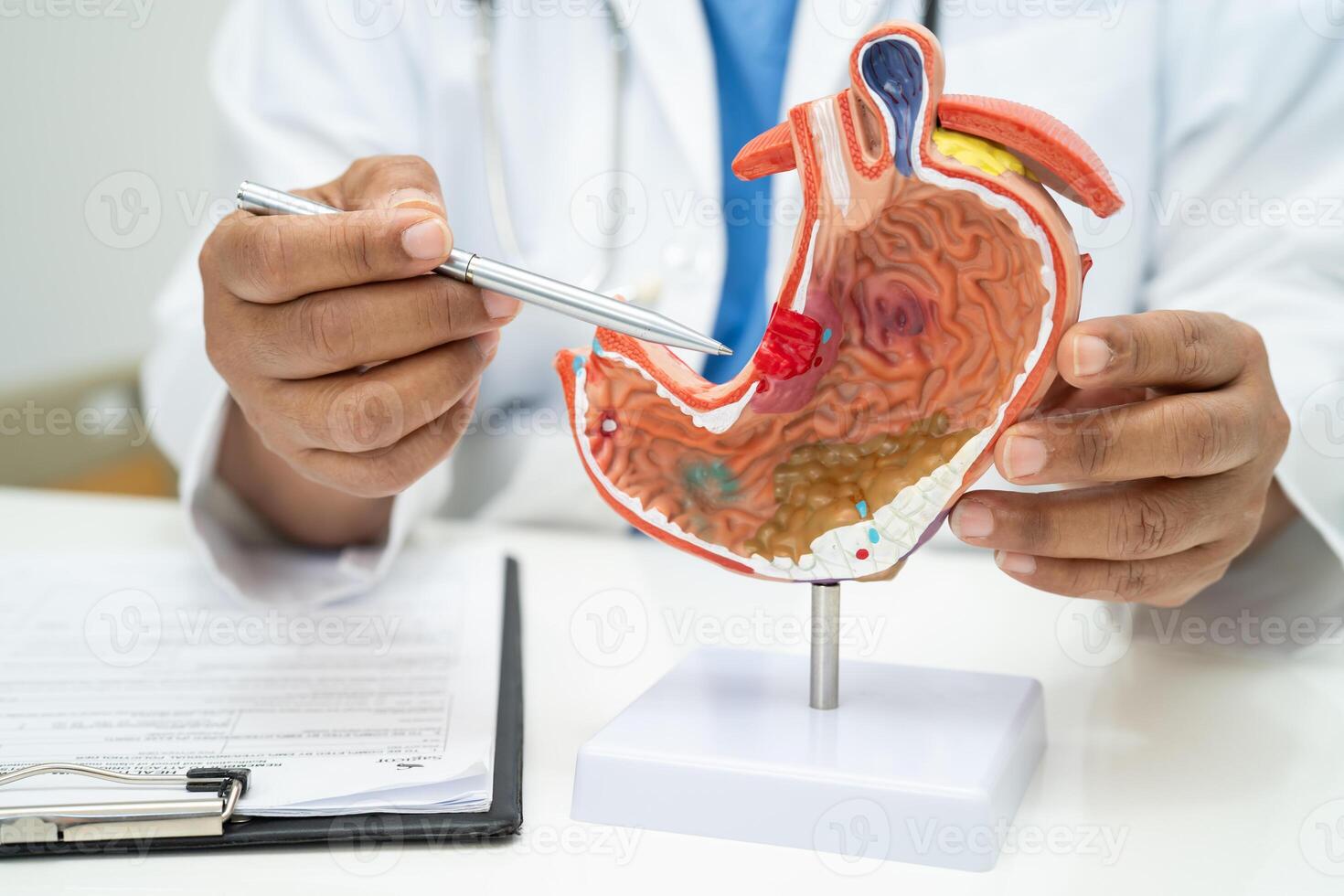Stomach disease anatomy photo