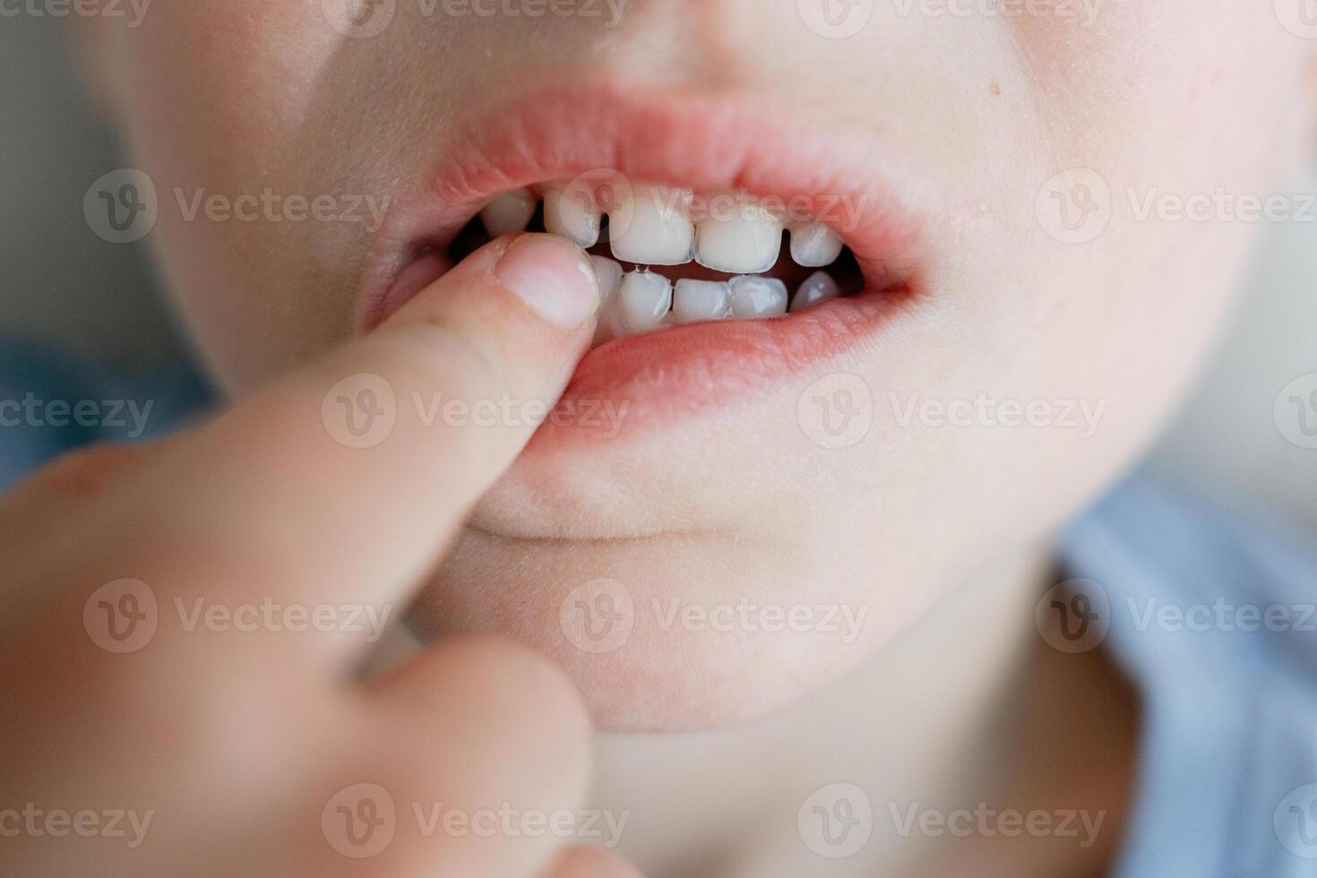 Child Pointing at Loose Tooth Close-Up photo