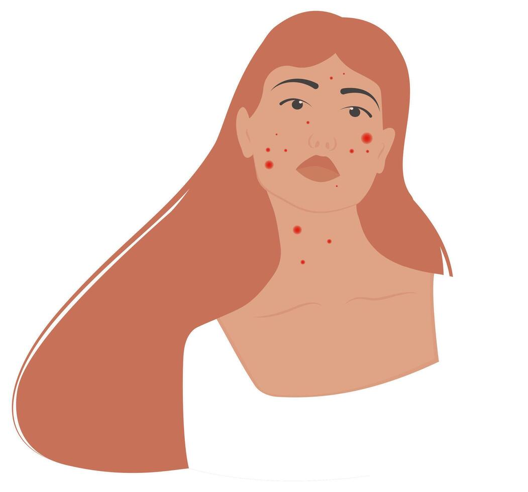 Girl with acne, problem skin concept vector