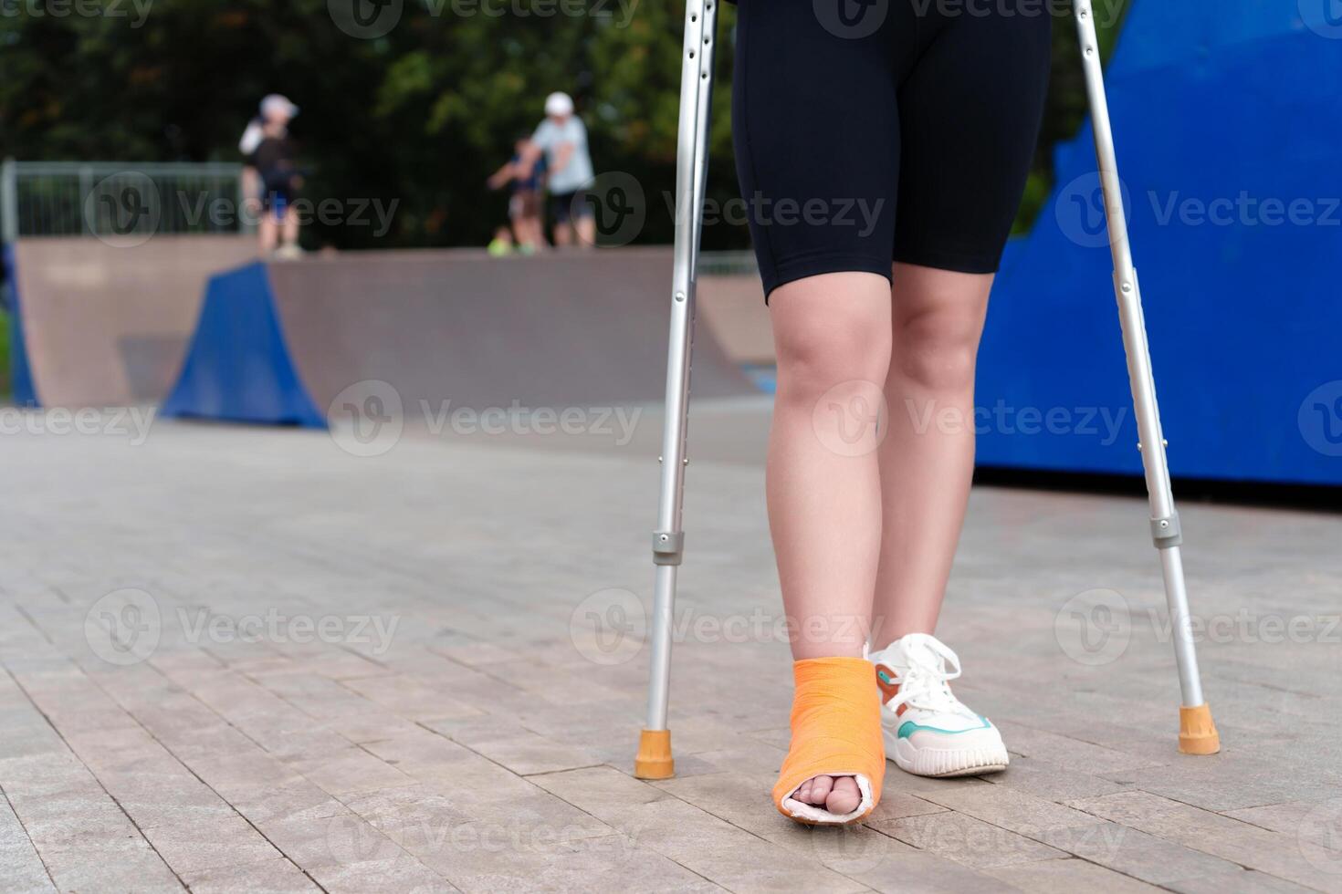 bandaged female leg in an orange bandage, is supported by crutches, a testament to resilience and rehabilitation, Against the vibrant backdrop of a summer skate park photo