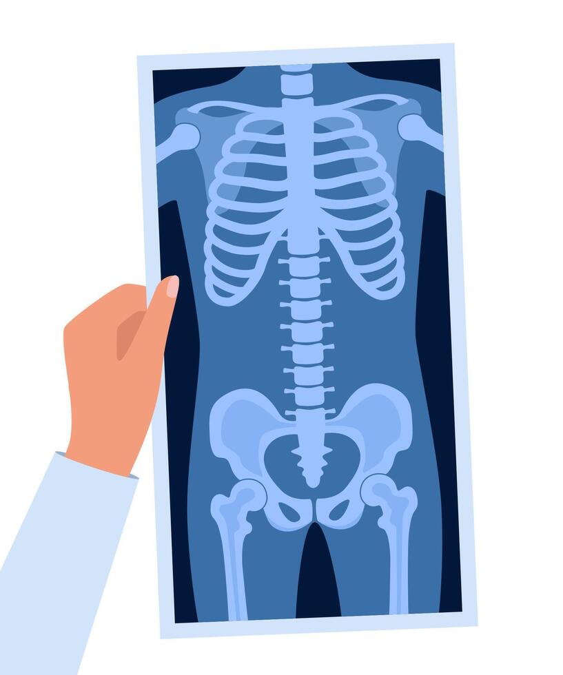 Human skeleton chest x ray image. Torso roentgen shot. Medical analyzing. Anatomical bone medicine laboratory radial scan. Roentgen shot in doctors hand. illustration. vector