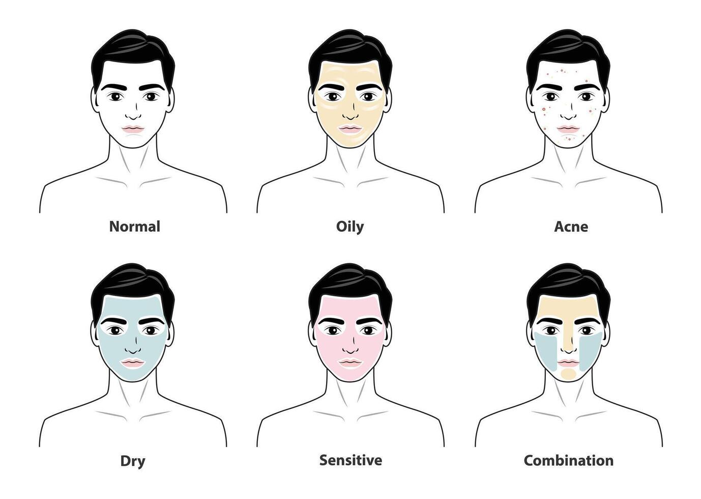 The man with skin types set isolated on white background. Different basic types of skin, normal, oily, acne prone, dry, sensitive and combination skin. Men skin care concept illustration. vector
