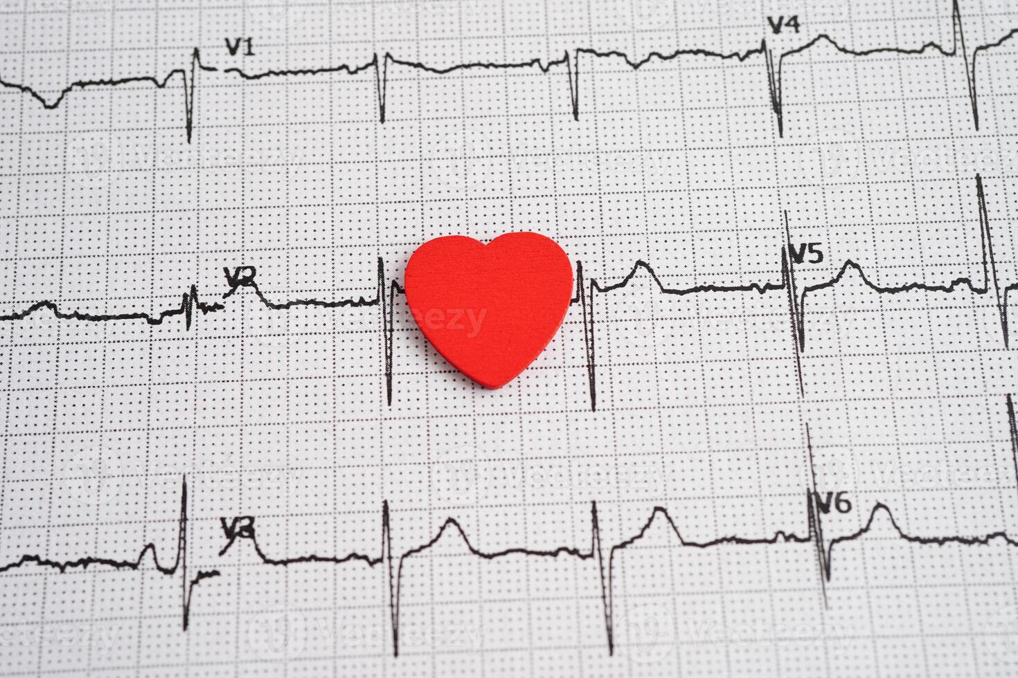 Red heart on Electrocardiogram paper to test check the heartbeat. photo