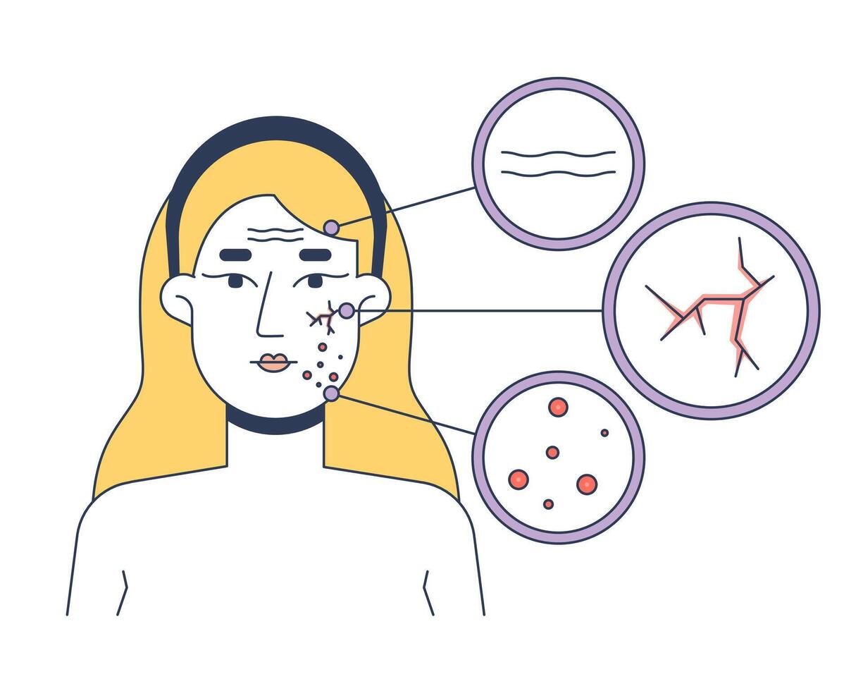 Blonde woman skin problems face diagram 2D illustration concept. Fine lines, broken capillaries, acne spots. Caucasian white female cartoon character isolated on white. Flat abstract metaphor vector