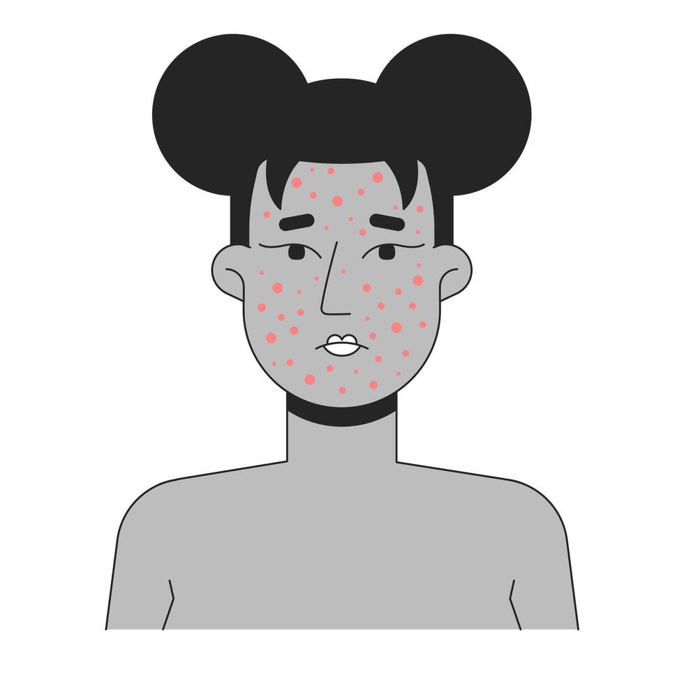 Black woman face with severe acne outline illustration. Pimples, rosacea, pustules. African american female facial skin breakout 2D line character isolated on white. Monochrome ink linear image vector