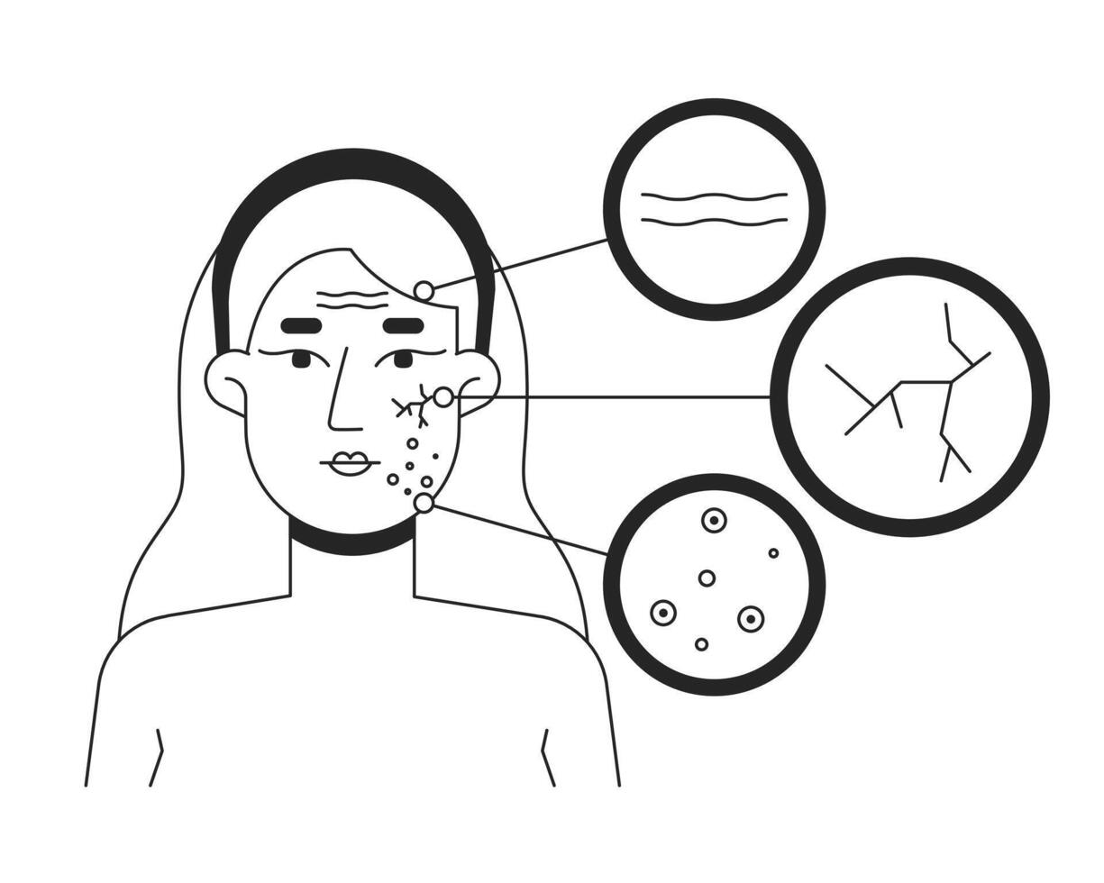 Blonde woman skin problems face diagram line illustration concept. Fine lines, broken capillaries, acne spots. Caucasian white female outline 2D character isolated. Ink linear metaphor art vector