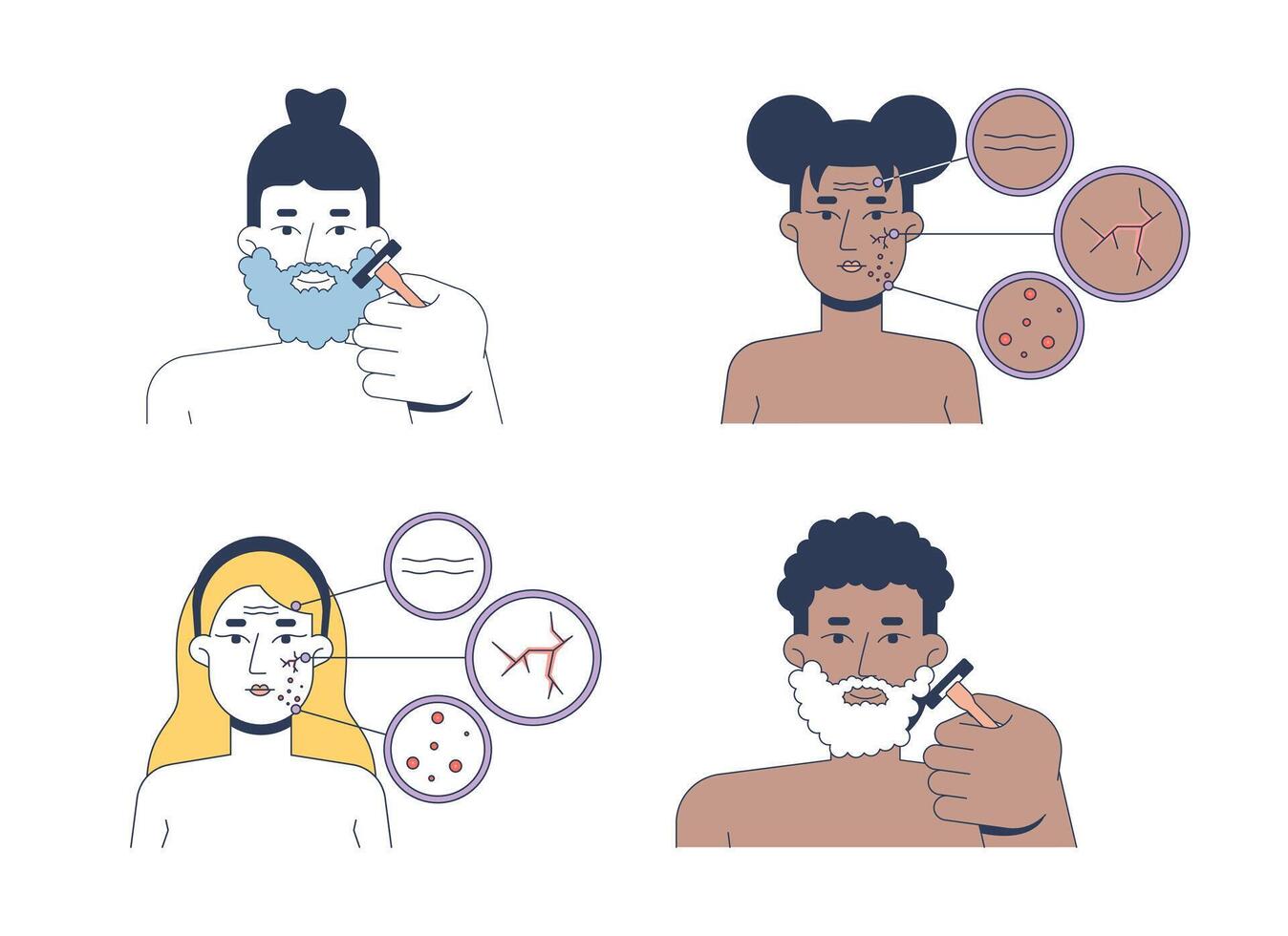 Face skin problems and shaving routine 2D illustrations set. Beard grooming, skincare dermatology. Diverse women, men flat characters isolated on white. Colorful cartoon images collection vector