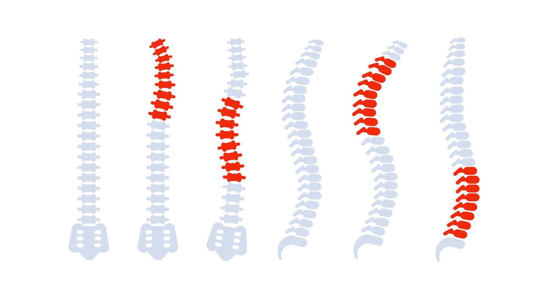 Spine bones with back pain highlighted showing different problems vector