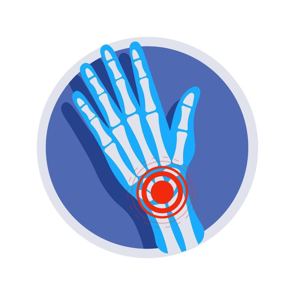X ray of a hand showing wrist pain inside a circle vector