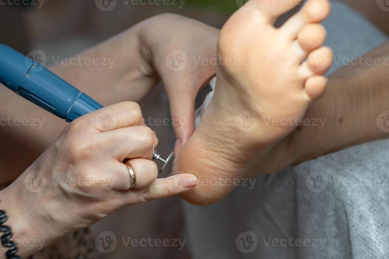 Modern peeling machine for feet. Skin care gadget for dry heels and cracked skin photo