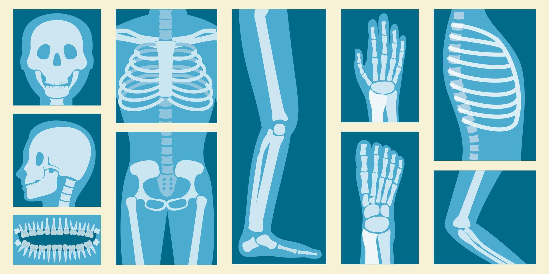 3D Isometric Flat Set of XRay Of Human Body Parts, Skeleton and Bones Scan vector