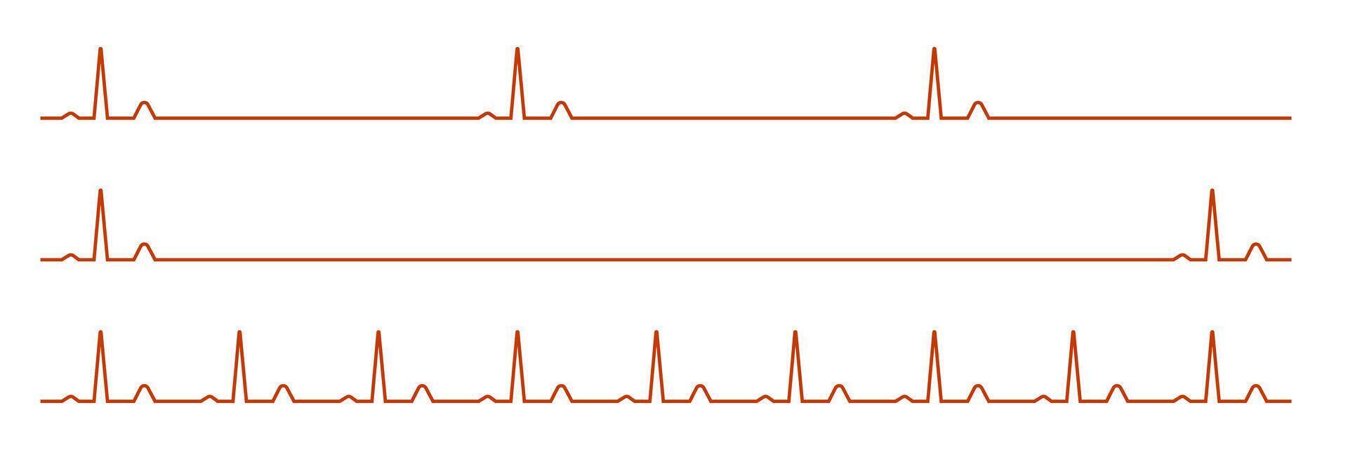Heartbeat variability patterns on ecg display in simple diagram format vector