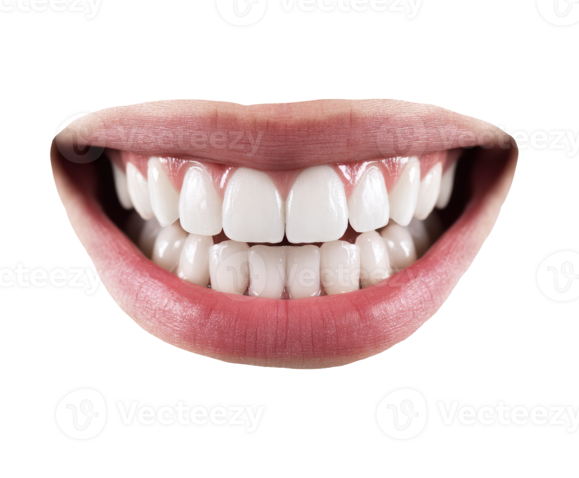 Bright and healthy smile with perfect white teeth for dental care png