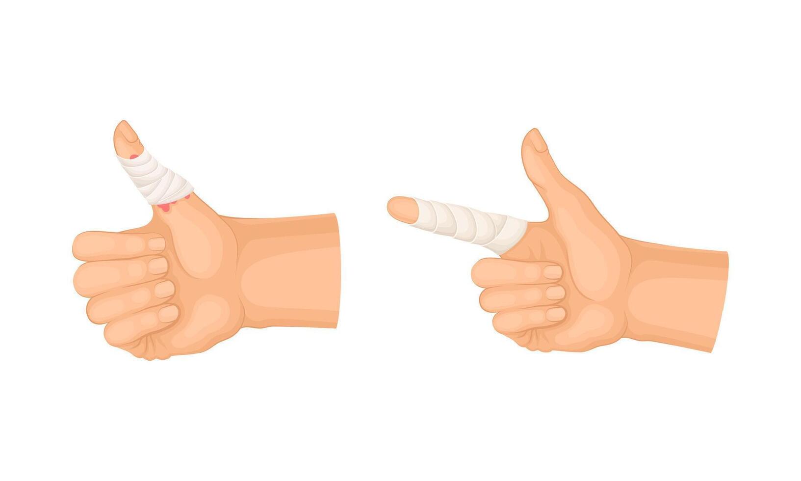 Wounded fingers with bandage. First aid for burn or cut wound illustration vector