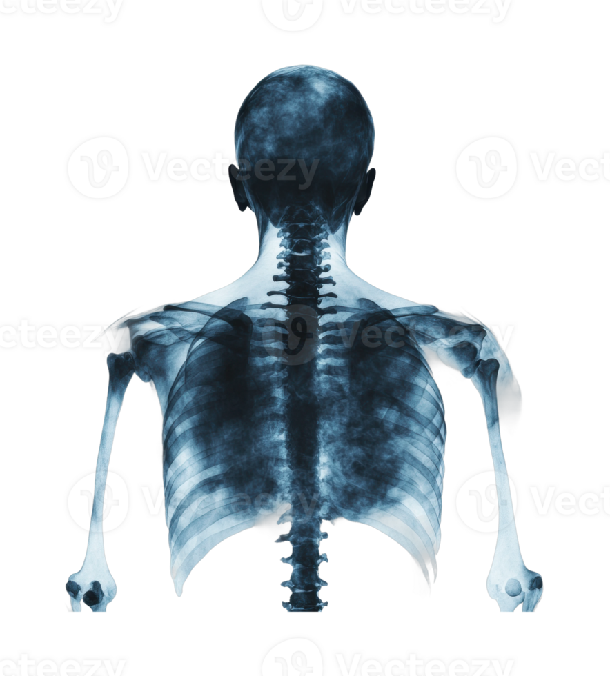 Human skeletal structure x-ray image highlighting spine and ribs png