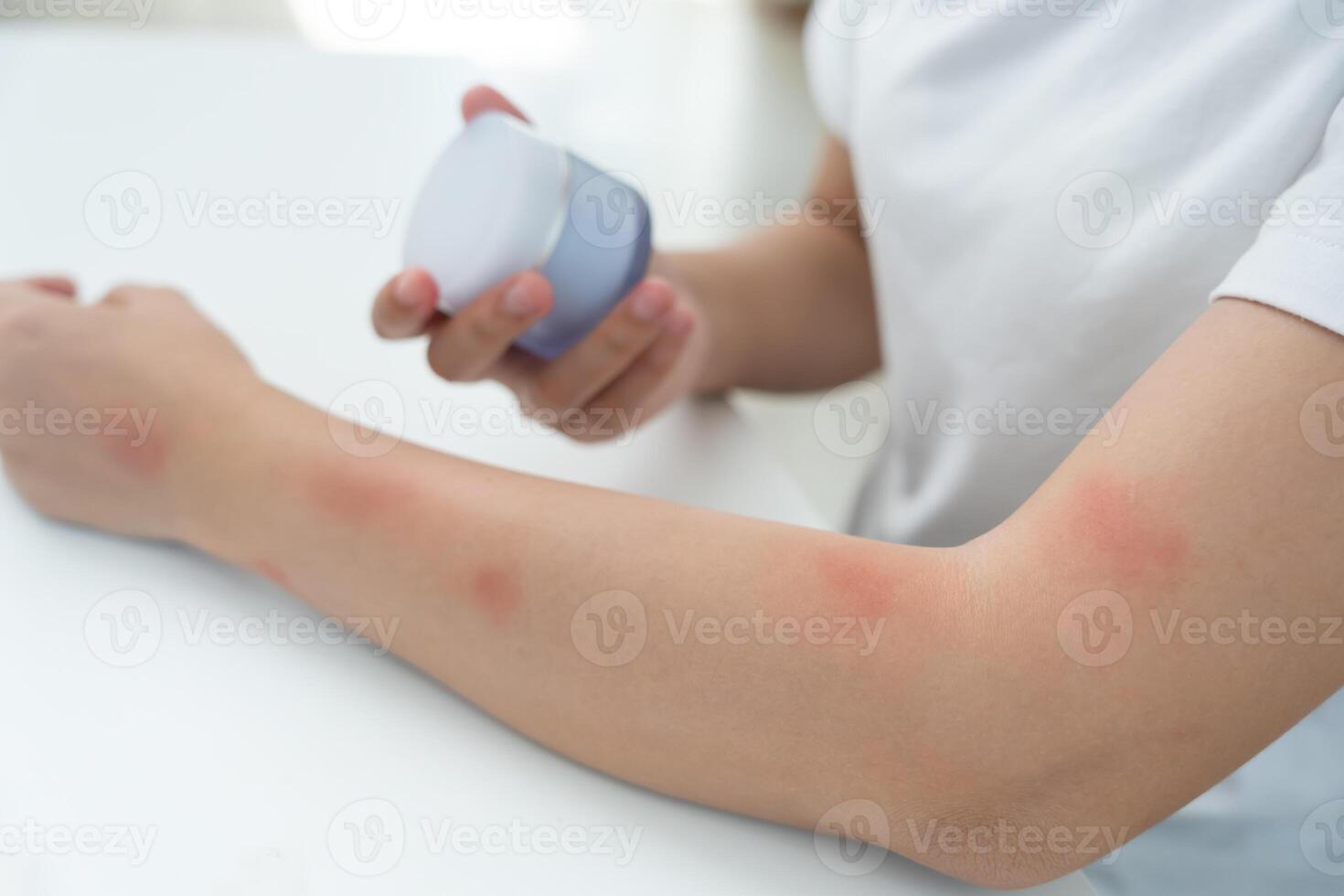 beauty problems Women have itchy skin and red rashes from cosmetic allergies, steroid allergies, sensitive skin, redness from sunlight chemical allergies rashes, insect bites photo